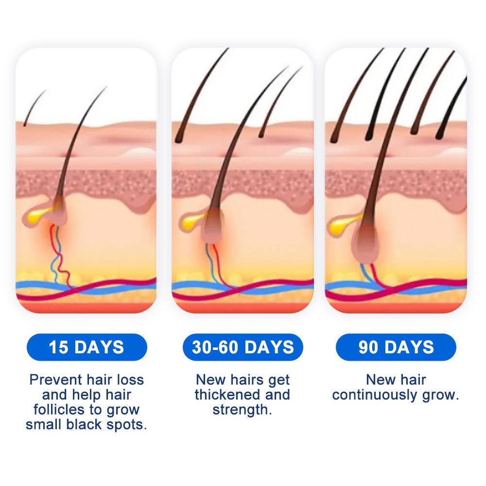 Alopecia Hair Growth Spray Sop - Hair Care Cream ulasan dan harga