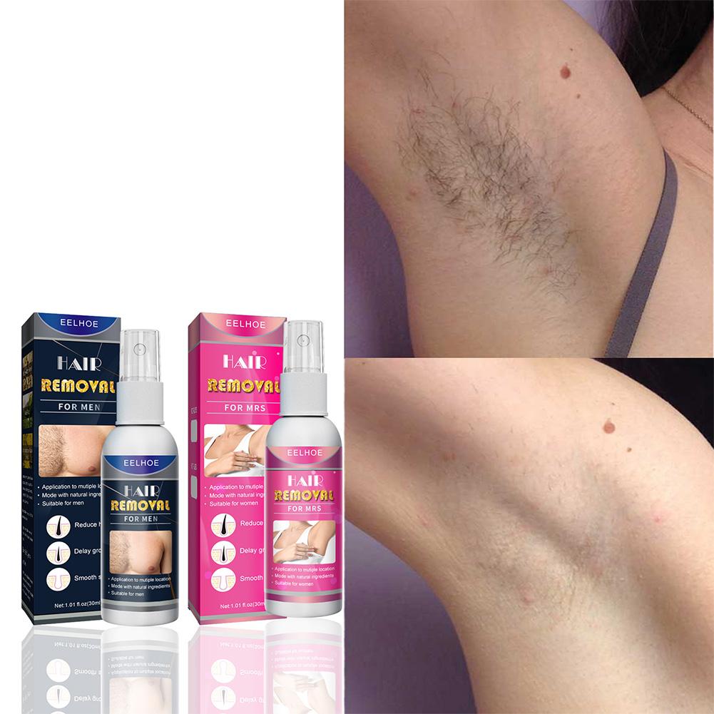 1/2PCS Super Natural Painless  - Hair Care Spray ulasan dan harga